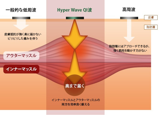 ハイパーウェーブについて 越谷 春日部の女性専用エステはアシークヴィーナス